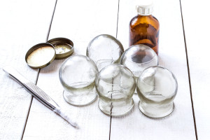 Old medical cupping glass, the alcohol in the bubble, petrolatum and tweezers with cotton wool on a white wooden table. They are used to relax the muscles and treat inflammation